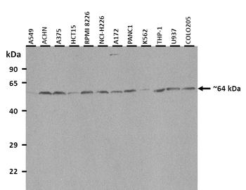 EYA1 Rabbit Polyclonal Antibody