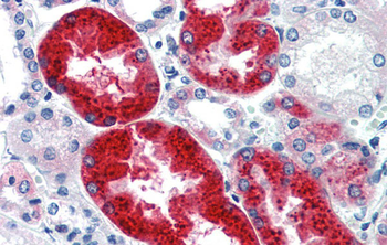 EYA1 Rabbit Polyclonal Antibody