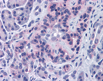 SIRT4 Rabbit Polyclonal Antibody