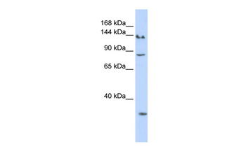 SIN3A Rabbit Polyclonal Antibody