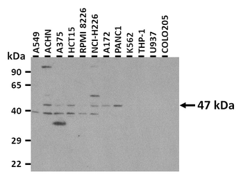 POU2F3 Rabbit Polyclonal Antibody