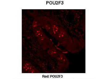 POU2F3 Rabbit Polyclonal Antibody