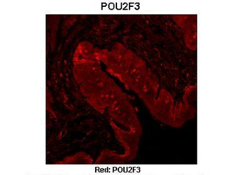 POU2F3 Rabbit Polyclonal Antibody