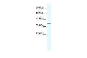 POU2F3 Rabbit Polyclonal Antibody