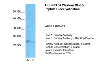 NPAS4 Rabbit Polyclonal Antibody