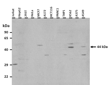 KLF15 Rabbit Polyclonal Antibody