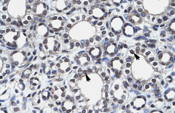 AIRE Rabbit Polyclonal Antibody