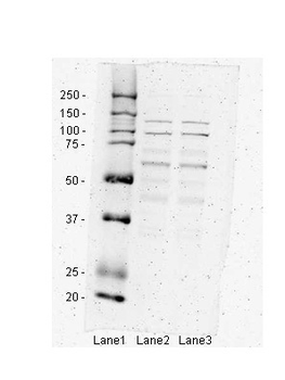 IKBKB Rabbit Polyclonal Antibody
