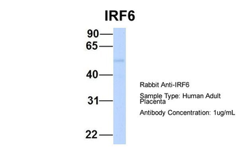 IRF6 Rabbit Polyclonal Antibody