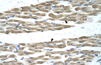 MYC Rabbit Polyclonal Antibody