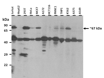 NR4A2 Rabbit Polyclonal Antibody