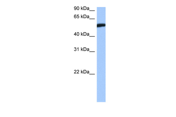 HMG20A Rabbit Polyclonal Antibody