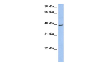 ACADM Rabbit Polyclonal Antibody