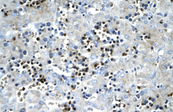 SCD Rabbit Polyclonal Antibody