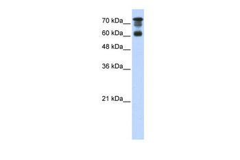 PPP1R13L Rabbit Polyclonal Antibody