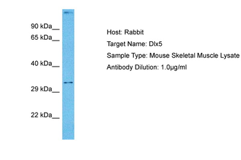 DLX5 Rabbit Polyclonal Antibody