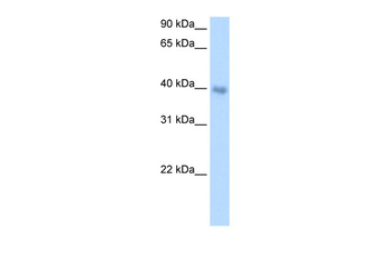 DLX5 Rabbit Polyclonal Antibody