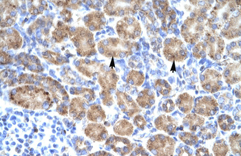 POU4F3 Rabbit Polyclonal Antibody