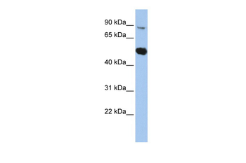 SOX6 Rabbit Polyclonal Antibody