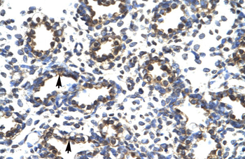PRDM14 Rabbit Polyclonal Antibody
