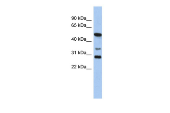 SOX3 Rabbit Polyclonal Antibody