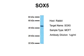 SOX5 Rabbit Polyclonal Antibody