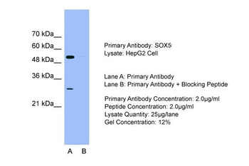 SOX5 Rabbit Polyclonal Antibody