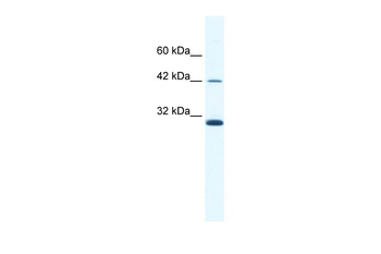 APOBEC3G Rabbit Polyclonal Antibody