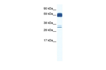 ZIC5 Rabbit Polyclonal Antibody