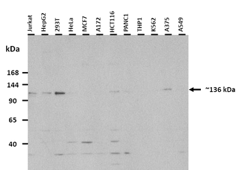 ZEB2 Rabbit Polyclonal Antibody