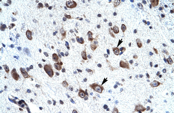 MORF4L2 Rabbit Polyclonal Antibody