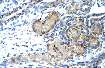 GTF2IRD1 Rabbit Polyclonal Antibody