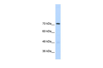 GTF2IRD1 Rabbit Polyclonal Antibody