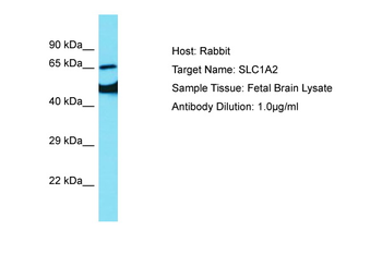 SLC1A2 Rabbit Polyclonal Antibody