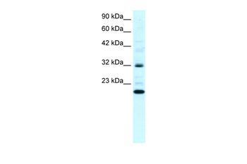 ARHGDIG Rabbit Polyclonal Antibody
