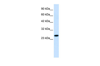 RGS13 Rabbit Polyclonal Antibody