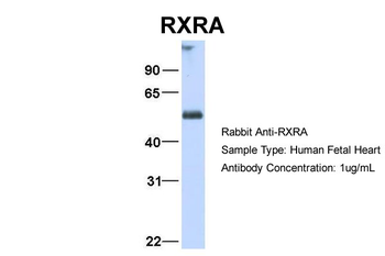 RXRA Rabbit Polyclonal Antibody