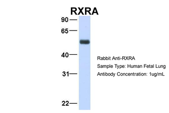 RXRA Rabbit Polyclonal Antibody