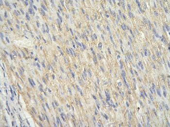 SIAH1 Rabbit Polyclonal Antibody