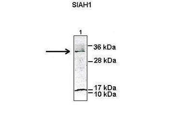 SIAH1 Rabbit Polyclonal Antibody