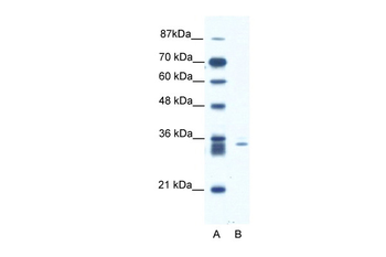 SIAH1 Rabbit Polyclonal Antibody
