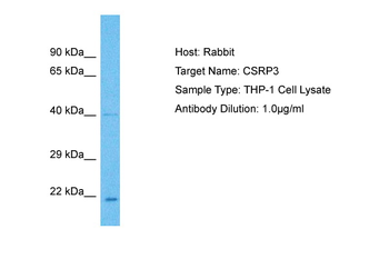 CSRP3 Rabbit Polyclonal Antibody