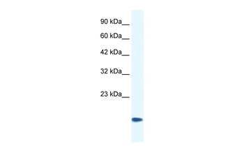 CSRP3 Rabbit Polyclonal Antibody