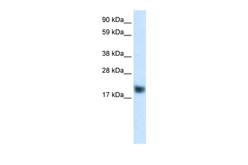 CSRP3 Rabbit Polyclonal Antibody