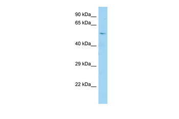 CDC25A Rabbit Polyclonal Antibody