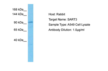 SART3 Rabbit Polyclonal Antibody