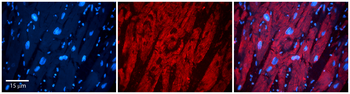 ZYX Rabbit Polyclonal Antibody