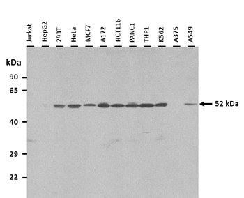 MEIS2 Rabbit Polyclonal Antibody
