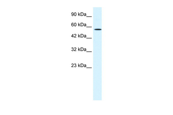MEIS2 Rabbit Polyclonal Antibody