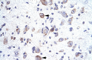 HOXA1 Rabbit Polyclonal Antibody